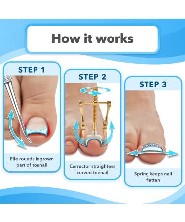 Dr. Krause 26 Pcs Ingrown Toenail Treatment Kit - Includes 16 Podiatry Toenail Braces - Complete Ingrown Toenail Corrector Set - Buy Online on GoSupps.com