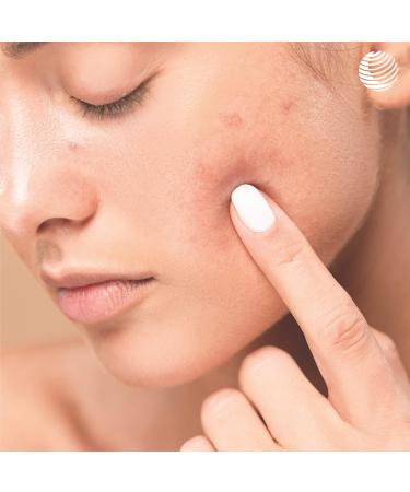 Dr. Rimpler 24-Hours Moisturizing Cream | Natural Face Cream for Impurities | Day & Night Care | 50ml - International Shipping Available - Buy Online on GoSupps.com