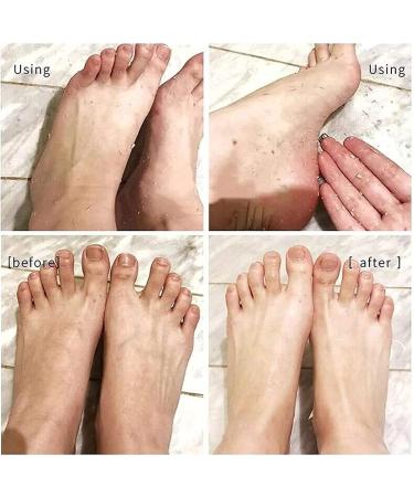 Anushka Foot Peeling Spray Oil | Remove Dead Skin & Calluses Instantly | Exfoliating Hydrating Peel Off Spray (Orange) - Buy Online on GoSupps.com