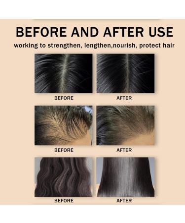 Hair Growth Oil 100% Pure Castor Oil Organic Natural Hair Growth Castor Oil for Hair Growth for Effective Hair Thickening Hair Mask & Hair Loss Treat Eyelashes and Eyebrows Repairs Hair - Buy Online on GoSupps.com