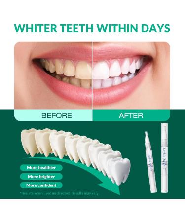 Effective Teeth Whitening Pen - 3 Pack | Remove Stains & Lighten Teeth Easily | Home & Travel Use - Buy Online on GoSupps.com