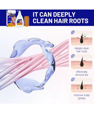 Lice Defense Daily Shampoo 300ml - Scalp Cleaning & Repellent for Home and Travel - Buy Online on GoSupps.com