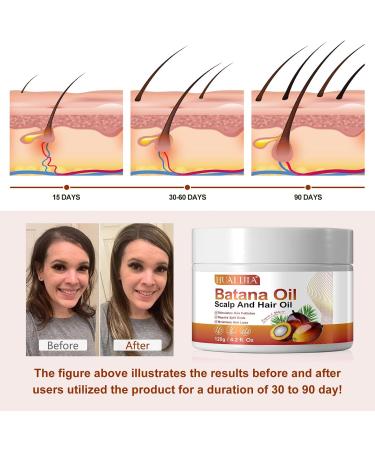 Raw Batana Oil for Hair Growth and Repair Pure & Organic Batana Oil from Honduras Stimulate Hair Growth Prevent Hair Loss and Enhances Hair Thicknes 120g - Buy Online on GoSupps.com