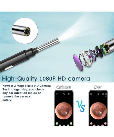 QDCFY OTOSKOK Wireless Endoscopic Camera - Ear Wax Removal Tool with LED for iPhone iPad & Android - Black - Buy Online on GoSupps.com