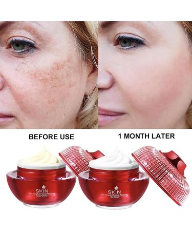 AILKE BOOST LUSTER Skin Whitening and freckle removal day and night pearl face cream with collagen hyaluronic acid impurities treatment rejuvenating skin - Buy Online on GoSupps.com