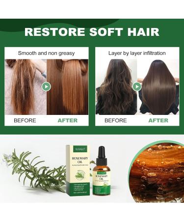 Buy YLNALO Rosemary Hair Growth Serum - Nourishes Scalp & Damaged Hair Stimulates Growth for All Hair Types (2.02 fl oz) - International Shipping Available - Buy Online on GoSupps.com