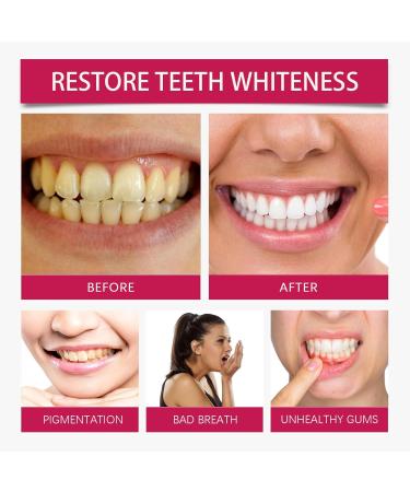 Baking Soda Whitening Toothpaste - Removes Surface Dirt Restores Whiteness Sensitive-Friendly Gentle Easy 2-3 Min Usage(2pcs) - Buy Online on GoSupps.com