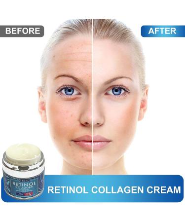 Retinol Cream with Collagen, Hyaluronic Acid, Vitamin C+E - Anti-Wrinkle Facial Moisturizer for Women and Men - Buy Online on GoSupps.com