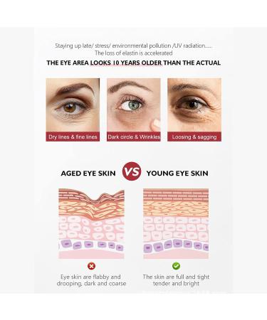 Retinol Anti-Aging Eye Cream 20g/0.7oz for Brightening & Tightening Skin - Men & Women - Buy Online on GoSupps.com