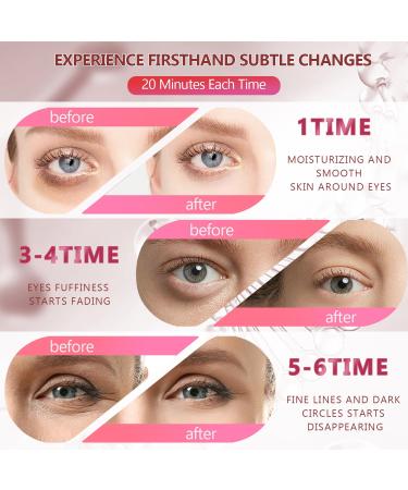 2 Packs 60 Pcs Under Eye Patches - 24K Gold & Pink Gel Masks for Dark Circles Puffiness and Wrinkles | Collagen Hydrating Eye Treatment for Men & Women - Buy Online on GoSupps.com