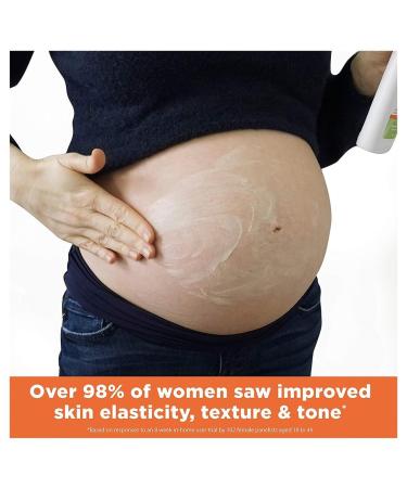 Palmer's Cocoa Butter Massage Lotion for Stretch Marks - 8.5 oz | Best Body Lotion for Women | International Shipping Available - Buy Online on GoSupps.com