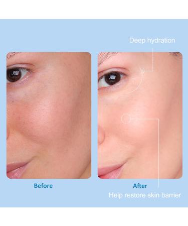 Best Facial Kits for Estheticians | Large 17.6 Fl Oz Skin Care Set | Hyaluronic Acid Products for Beauty Salons | Paraben Free - Buy Online on GoSupps.com