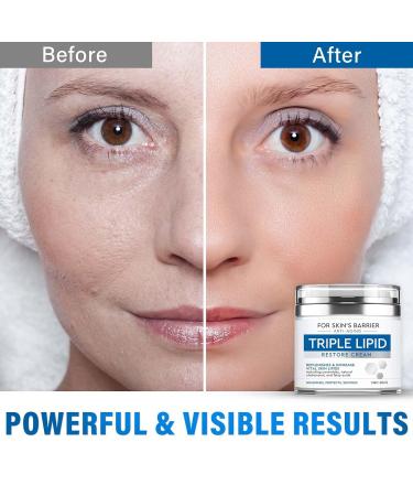 Triple Lipid Restore Cream | Anti-Aging Peptide Moisturizer with Fatty Acids & Ceramides | Nourish & Repair Skin Barrier - Buy Online on GoSupps.com