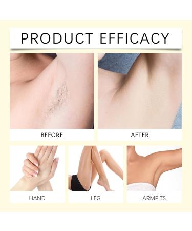 VKaoess Hair removal cream for sensitive skin mild hair removal for face body and intimate areas painless unisex solution for women and men safe for sensitive skin 20g 2 pieces - Buy Online on GoSupps.com