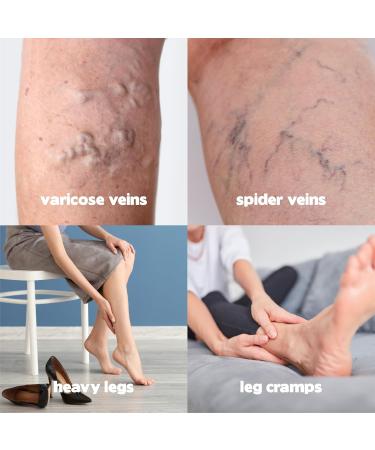 HillVital Varicose Veins Treatment Cream - Natural Horse Chestnut & 14 Herbs for Spider Veins & Leg Relief - Buy Online on GoSupps.com