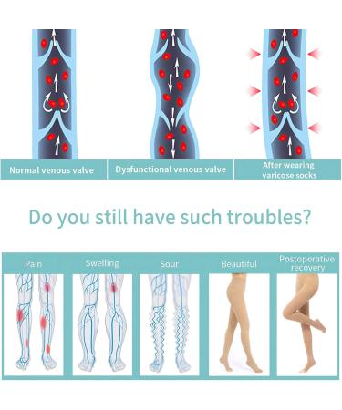 Evolyline 20-30mmHg Medical Compression Tights for Women & Men | Class II Support Stockings for Varicose Veins Edema & Pregnancy - Open Toe Beige XXL - Buy Online on GoSupps.com