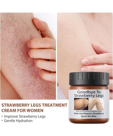 Strawberry Legs Treatment Cream For Women Keratosis Pilaris Lotion Chicken Skin Treatment Moisturizing Strawberry Skin Smooth Radiant Skin Care Solution Exfoliating Body Cream 120G - Buy Online on GoSupps.com