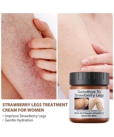 Strawberry Legs Treatment Cream | Exfoliating Lotion for Keratosis Pilaris & Dry Skin | Radiant & Smooth Skin Solution - Buy Online on GoSupps.com