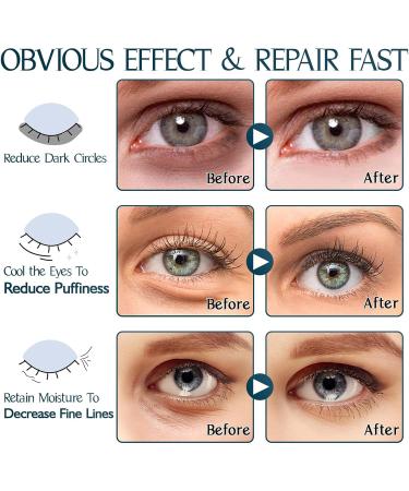 Under Eye Patches Aloe Vera Eye Masks for Puffy Eyes Under Eye Masks Dark Circles Under Eye Treatment Women Under Eye Bags Removal and Anti Wrinkle Hydrating Skincare 30 Pairs - Buy Online on GoSupps.com