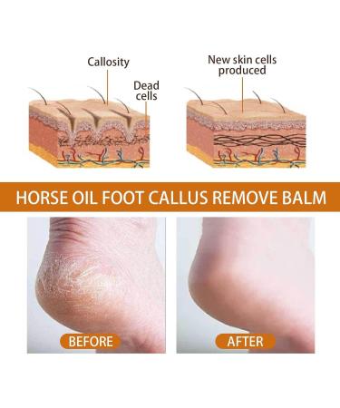 IFFANY Horse Oil Foot Care Cream Oil Foot Wounded Tissue Repair Cream Oil Foot Aftering Cream Raise Keratin and Moisturize Skin - Buy Online on GoSupps.com