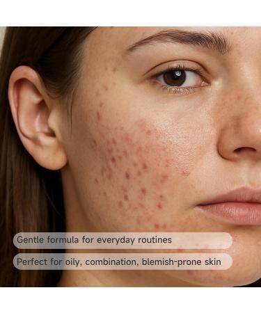 Vectium Azelaic Acid 10% + Salicylic Acid 2% Facial Serum for Oily & Blemish-Prone Skin Daily Post-Breakout Care Lightweight Serum 30ml (1 Fl Oz) - Buy Online on GoSupps.com