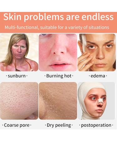 Rose Flower Ice Facial Roller 2pc/Set | Cute Cactus Shape | Reusable Ice Mold for Face | Reduce Puffiness & Pores | Facial Beauty Care Tool - Buy Online on GoSupps.com