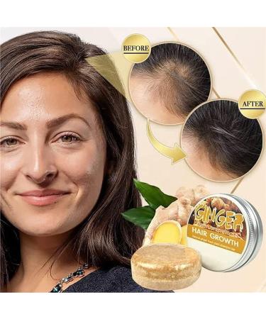  oihgerg 2Pcs Ginger Hair Regrowth Shampoo Bar Organic Solid Shampoo Bar AntiHair Loss Natural Ginger Shampoo Soap for Hair Growth Repair - Buy Online on GoSupps.com