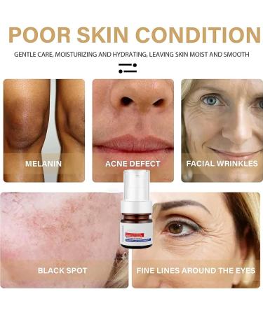 Aobenz Serum Aobenz Whitening and Freckle Removing Essence Aobenz Anti-Spot Serum Aobenz Spot Remover Serum Aobenz Dark Spot Correcting Serum Aobenz Spot Remover for Face Wrinkle Power (2pc) - Buy Online on GoSupps.com