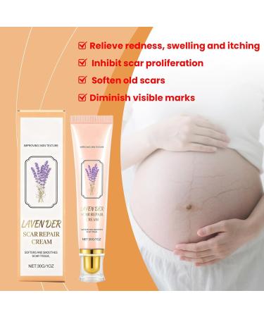  Chaies Scar Removal Cream Skin Texture Improvement Products - Scar Removal Smoothing Cream For Men Women Boys Girls Teenagers and Athletes - Buy Online on GoSupps.com