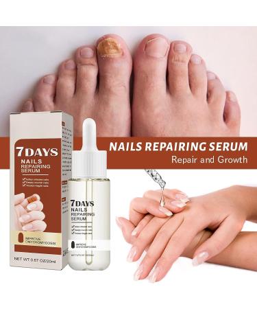 2Pcs Nail Repair Serum Set | 7 Days Growth & Strengthening Solution | Cuticle Oil Strengthener for Damaged Nails - Buy Online on GoSupps.com