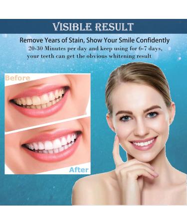 Teeth Whitening Gel Refills for Sensitive Teeth - Professional Whitening Pens for Clean, Stain-Free Teeth - 6Pcs x 3ML - Buy Online on GoSupps.com