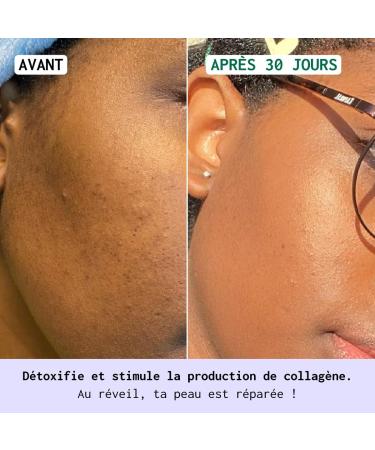 NUBIANCE - Anti-Dark Spot Night Cream for Face - Antioxidant - Corrects Pigment Spots and Boosts Collagen Production - Black Dark and Mixed Skin - 50ml - Buy Online on GoSupps.com