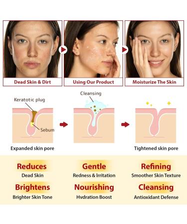 ikzee Peel Shot Glow Rice Ampoule Duo with niacinamide and arbutin Pure Skin Peel Shot gentle peeling rice peeling face deep effective moisture care Rice Peel Glow Serum 100ml rice exfoliant 1PACK - Buy Online on GoSupps.com