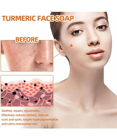 Turmeric Soap Anti-Dark Spot Turmeric Face Soap Kojic Turmeric Soap Kojic Acid Lightening Soap Solid Face Soap Bar For Face Pimples And Black Spots (1PC) - Buy Online on GoSupps.com