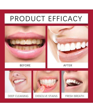 KLYso Gentle Gum Care Toothpaste - Teeth Whitening & Stain Removal Enamel Protection Brighten & Polish for A Radiant Smile(2PCS) - Buy Online on GoSupps.com