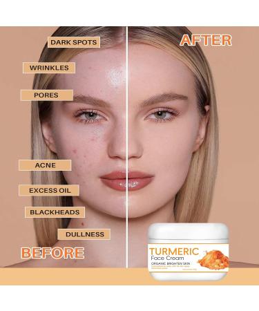 Turmeric Face Cream Turmeric Anti Aging Face Cream for Face Face Moisturiser Moisturiser Face Women with Vitamin C for Reduces Fine Lines & Wrinkles & Moisturize Face Cream for All Skin Typle - Buy Online on GoSupps.com