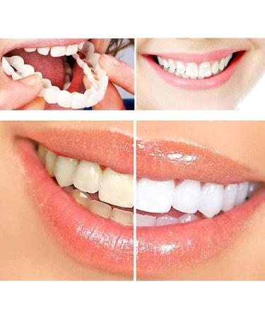Giural 2 Pairs False Teeth Veneers - Instant Perfect Smile | Cosmetic Temporary Braces for Imperfect Teeth - Buy Online on GoSupps.com