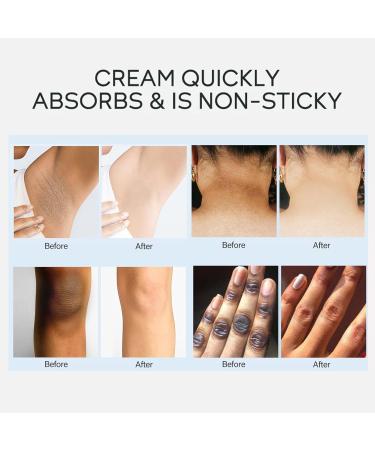 Skin Whitening Cream for Acanthosis Nigricans Skin Lightening Cream for Dark Skin Skin Bleaching Cream with Retinol for Hard Skin Fade Melanin Body Armpit Knees Elbows & Knuckles - Buy Online on GoSupps.com
