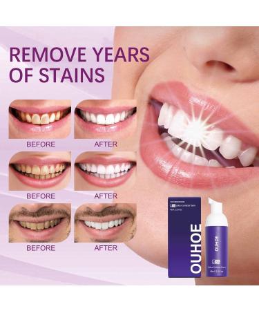 Buy 2 Pieces Purple Teeth Whitening Toothpaste | V34 Color Corrector for Deep Stain Removal | Brighten Yellow Teeth Effectively - Buy Online on GoSupps.com