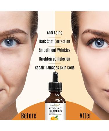 30% Vitamin C Serum for Face - Anti-Aging & Skin Rejuvenator with Hyaluronic Acid Vitamin B3 E Jojoba & Aloe Vera - Natural & Organic Moisturizer (1 FL OZ - Buy Online on GoSupps.com