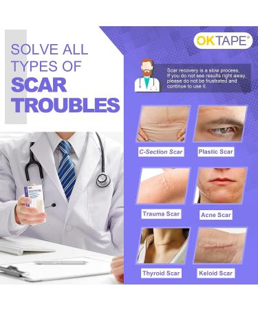 OK TAPE Silicone Scar Tape Roll - Professional Scar Removal Sheets for Surgical Scars - Reusable Silicone Strips for Keloid, C-Section, Tummy Tuck - 1.6 x70 Roll - Buy Online on GoSupps.com