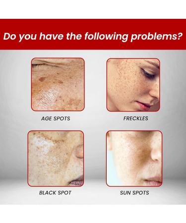  BEROZA Set of 3 Creams for Face Spots Whitening Cream for Freckles Dark Spot Removal Cream Cream for Dark Spots Skin Lightening Cream for Face Spots - Buy Online on GoSupps.com