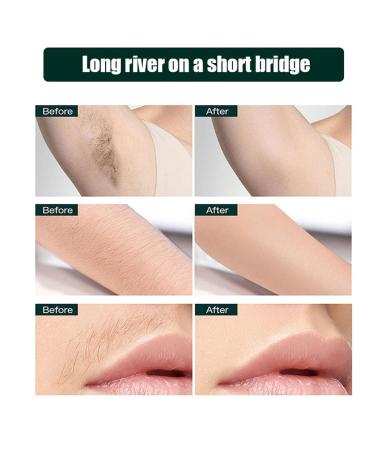 Natural Wax Strips for Legs - 20 Durable & Washable Hair Removal Strips for Body Arms & Forearms | Unisex Waxing Solution - Buy Online on GoSupps.com