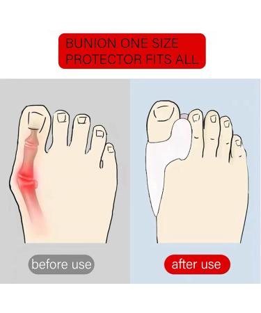 DAPIN Bunion Corrector 6 Pack - Toe Straightener, Separator & Protector Set for Bunion Relief - Buy Online on GoSupps.com
