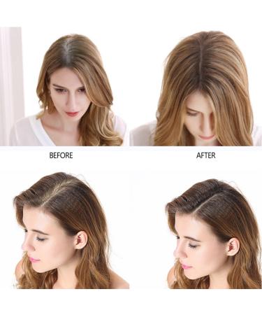 Medium Brown Hair Fiber Powder for Baldness Concealer and Thickening Hair - Women Men Hair Loss Concealer for Thinning Hair - Buy Online on GoSupps.com