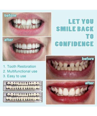 Euppsiiu 2-Piece Acrylic Resin False Teeth Veneers - Cosmetic Tooth Covers & Temporary Dental Prosthesis - Buy Online on GoSupps.com