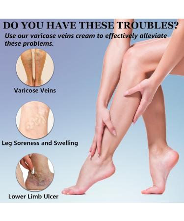 2 Pcs Varicose Veins Cream Varicose Veins Treatment Cream for Leg Skin Repair Improve Blood Circulation Gently Soothe & Moisturize Relieves Legs Discomfort & Reduce Heaviness 20g Each - Buy Online on GoSupps.com