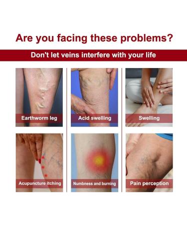  Orgrul Algae ointment for spider veins Varicose Vein Cream for spider veins varicose veins leg cream leg ointment care refreshment and relaxation of swollen legs and - Buy Online on GoSupps.com