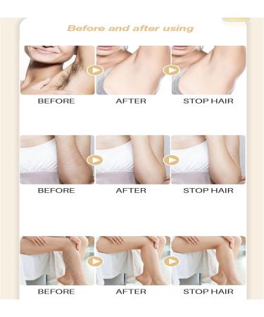 S rum anti-pousse des cheveux pilateur naturel pour le visage les aisselles les jambes et les bras 10 ml x 2 pi ces - Buy Online on GoSupps.com