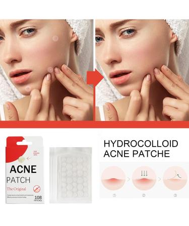 Zit Patches for Acne - 108Pcs Tea Tree Oil Clear Invisible Hydrocolloid Spot Dots - Day & Night Use - Buy Online on GoSupps.com